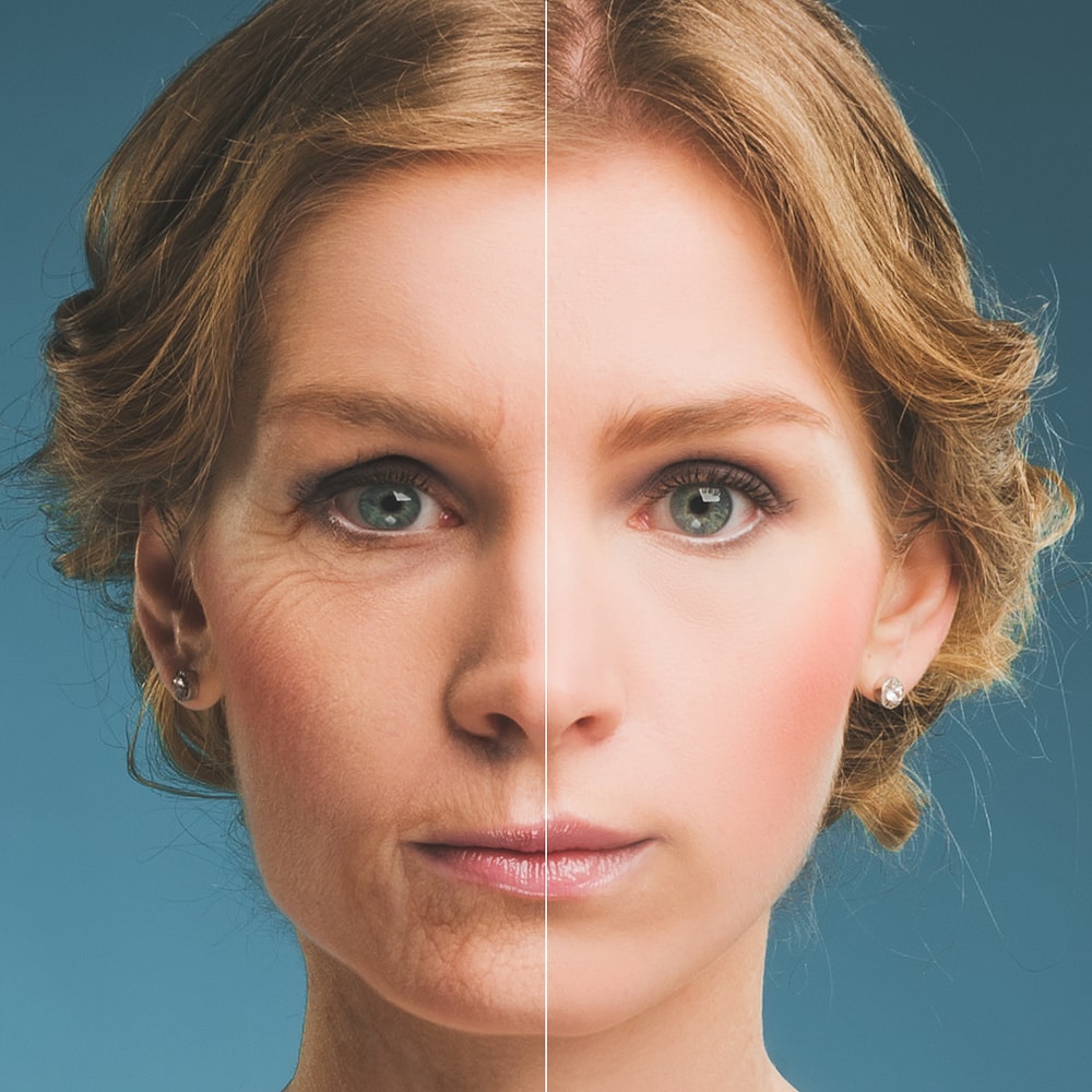 An aging lady and a young lady split in half to show the contrast