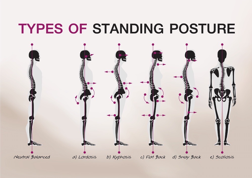 types of standing posture