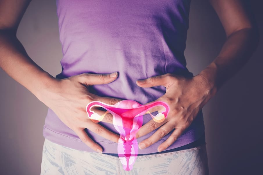 6 myths about polycystic ovary syndrome (PCOS)